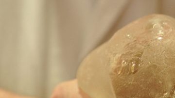 Las prótesis mamarias PIP fueron fabricadas con silicona industrial.
