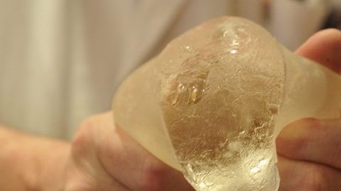 Las prótesis mamarias PIP fueron fabricadas con silicona industrial.