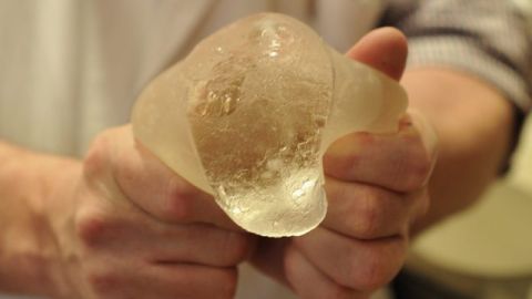 Las prótesis mamarias PIP fueron fabricadas con silicona industrial.