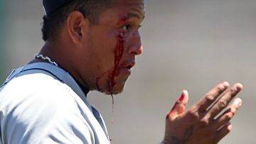 Miguel Cabrera se limpia la sangre tras ser impactado por un batazo.