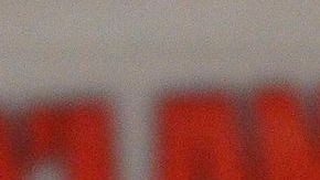 Chávez cuenta que recibe cinco sesiones de radioterapia, todos los días, una por día, durante cinco días consecutivos.