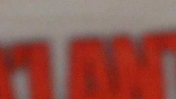 Chávez cuenta que recibe cinco sesiones de radioterapia, todos los días, una por día, durante cinco días consecutivos.