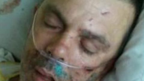 El hombre, identificado como Matthew Owens, aún se encuentra hospitalizado por encontrarse en condición crítica a raíz de los golpes  que recibió.