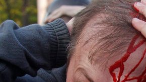 Un manifestante herido que protestaba contra la investidura de Vladimir Putin, en Moscú, Rusia.