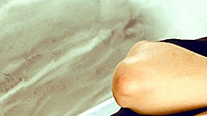 IM_20120507_SALUD_120509485