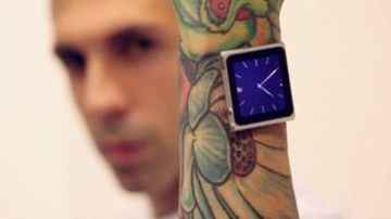 Dave Hurban muestra en un video el iPod que lleva en su brazo.