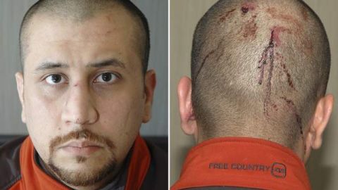 Esta foto combinada de George Zimmerman se encuentra entre 200 de ellas y reportes de testigos autorizados para el juicio por la fiscalía y la defensa.
