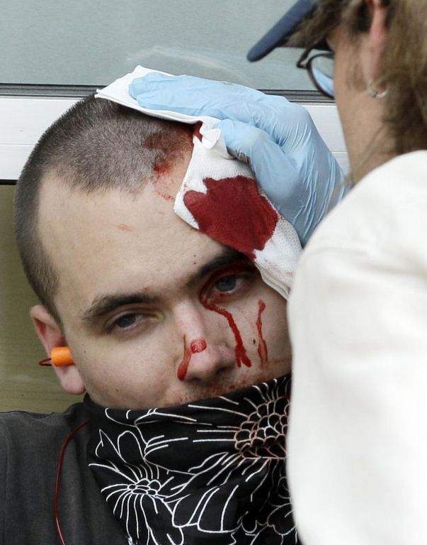 Un manifestante es atendido por golpes en la cabeza.