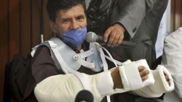 Gabriel Granados Vergara, un mexicano de 52 años se convirtió en la primera persona en recibir un transplante de brazos en México y en América Latina.