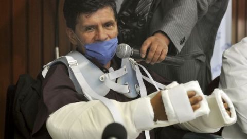 Gabriel Granados Vergara, un mexicano de 52 años se convirtió en la primera persona en recibir un transplante de brazos en México y en América Latina.