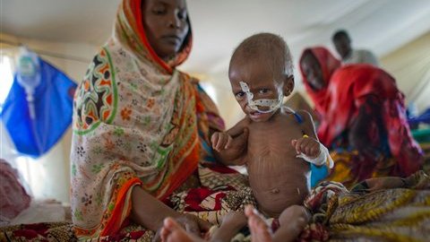 Una madre proporcionando nutrición vía nasal a su hijo en Chad.