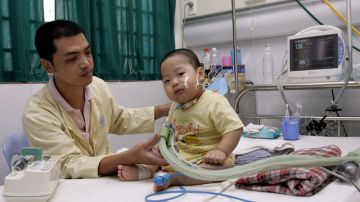 Tran Nam Trung ajusta el tubo del respirador en la garganta del pequeño Minh Giang, de 20 meses de edad.