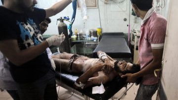 Un rebelde sirio, herido, recibe tratamiento médico, ayer,  en un hospital de Alepo, Siria.
