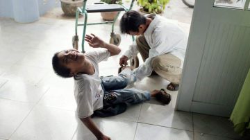 Un niño afectado por el Agente Naranja en Danang, Vietnam.