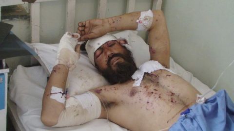 Supuesto talibán recibe atención médica en un hospital, tras resultar herido el sábado en ataque aéreo de la OTAN, en Kunar.