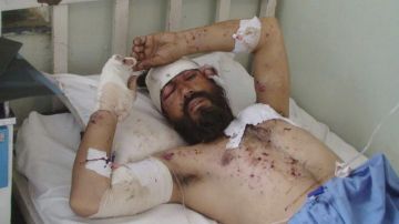 Supuesto talibán recibe atención médica en un hospital, tras resultar herido el sábado en ataque aéreo de la OTAN, en Kunar.