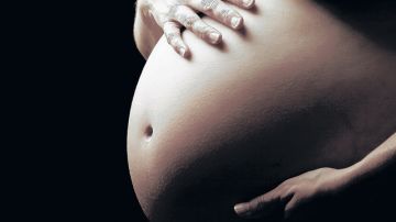 El paño, como se conoce a las manchas en la piel durante el embarazo, no debe ser motivo de alarma.