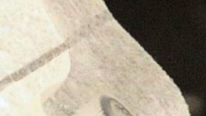 El brote se asocia a inyecciones para el dolor de espalda en mal estado.