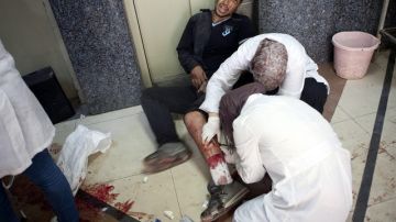 Un civil herido en un bombardeo de la fuerzas leales al régimen sirio, en el hospital Dar al Shifa, en Aleppo, Siria.