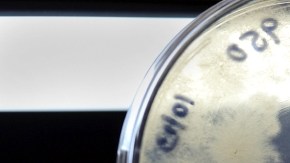 Un laboratorista del CDC analizan una muestra de un hongo de meningitis enontrado en  Atlanta, Georgia