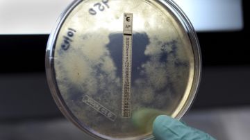 Un laboratorista del CDC analizan una muestra de un hongo de meningitis enontrado en  Atlanta, Georgia