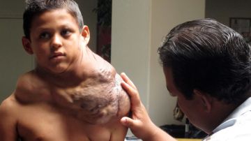 El niño mexicano llamado José tiene la esperanza de que médicos en Estados Unidos le curen y así poder volver a la escuela, ese es su mayor anhelo. Su familia también viajará desde Ciudad Juárez.