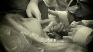 La fotografía fue puesta en la cuenta de Facebook de Alicia Atkins, madre de la bebé que es captada en el momento en que el galeno la saca del vientre de su madre, que tuvo que someterse a una cesárea para dar a luz.