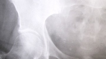 IM_20130212_SALUD_130219816