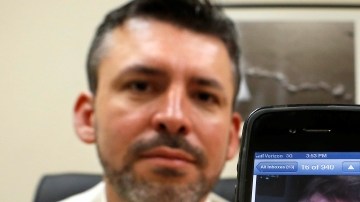 Mark Magee y su esposa Lucinda Winward muestran la foto de su hijo Jack con la herida que sufrió al caerse en un centro de cuidado infantil de un gimnasio de Sacramento.