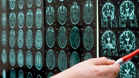 La revolucionaria técnica, denominada Clarity, consiste en un proceso químico  que pone transparente al cerebro sin alterar su forma ni conexiones.