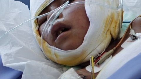Rosalía Apaza Pillco tiene deseos de salir adelante, pues ha luchado como fiera por su vida.