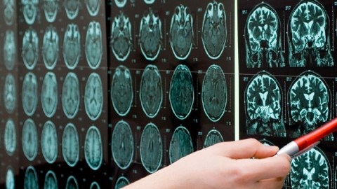 Poco se ha investigado sobre el autismo en la edad adulta.