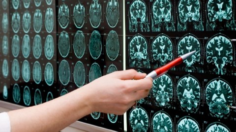 Poco se ha investigado sobre el autismo en la edad adulta.
