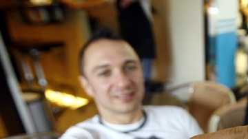 El riesgo de calvicie es mucho mayor entre los fumadores.