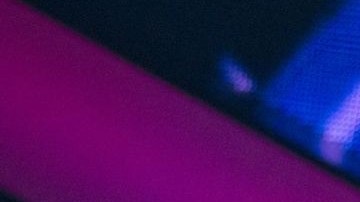 José José no sufrió lesiones mayores tras la fuerte caída del escenario..