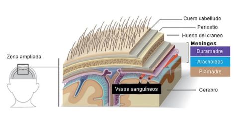 La lesión cerebrovascular de presidenta argentina es una acumulación de sangre entre dos de las tres membranas que recubren el cerebro.