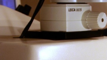 La cirugía refractiva ha corregido la vista a millones de personas.