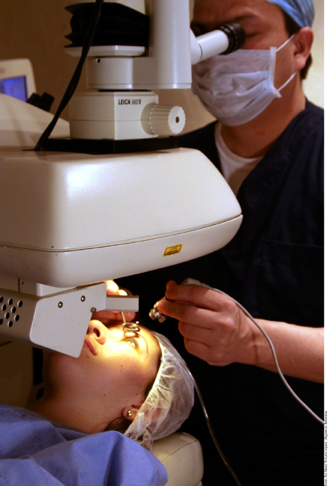 La cirugía refractiva ha corregido la vista a millones de personas.
