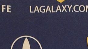 Los reflectores y la usual atención de la prensa a 'Beck's'.