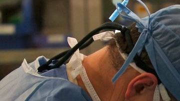 Las operaciones de cara, utilizando los cadáveres de los donantes, son todavía experimentales.