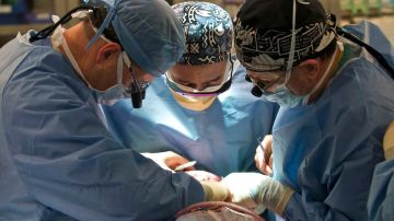 Las operaciones de cara, utilizando los cadáveres de los donantes, son todavía experimentales.