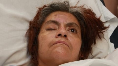 La mujer fue atropellada el 15 de octubre del 2013. Desde entonces, no han logrado identificarla ni contactar a sus familiares.