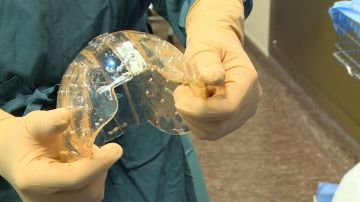 Imagen del cráneo implantado con éxito en paciente de 22 años.