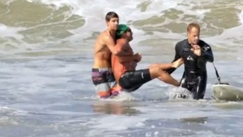 Steve Robles sufrió el ataque en la playa Manhattan en California, el sábado en horas de la mañana.