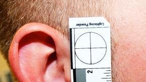 Evidencia muestra un leve moretón en la cara de Wilson.