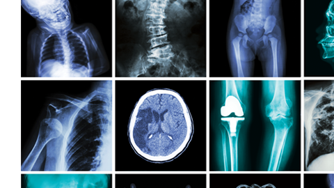 Evita los rayos X siempre que puedas.