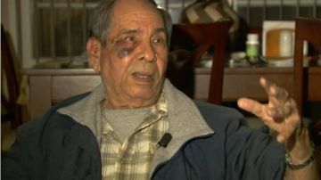 Raúl Fonseca, de 79 años, relata la paliza que recibió el pasado 14 de febrero.