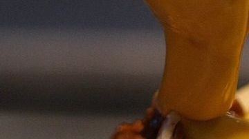 De acuerdo con los Centros para el Control y Prevención de Enfermedades, en 2014 se registraron 161 casos de botulismo en EEUU.