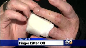 Clabe Hartley sufrió la perdida de parte de su dedo tras el altercado con un hombre desamparado.