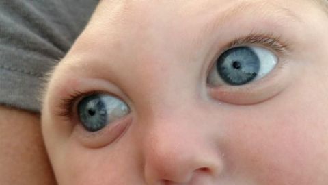 El caso de Jaxon es excepcional. Los médicos aseguraron que tan sólo viviría unas horas.